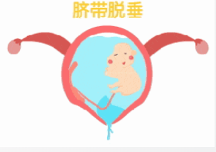 孕婦臍帶先露！阜陽市婦女兒童醫(yī)院婦產(chǎn)急救中心爭分奪秒，護佑母嬰安全！